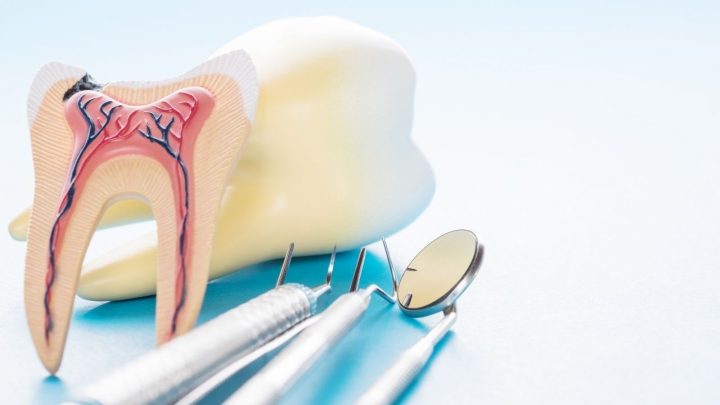 Cuidados no pós operatório do dente do siso